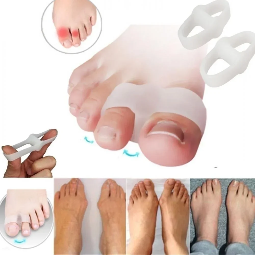2 Holes Bunion Corrector Pain  - Correction Fluid White 리뷰 및 가격